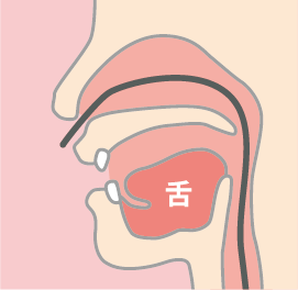 経鼻の場合