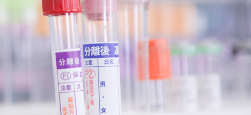 【日本橋】生活習慣病健診での痛風検査（尿酸）